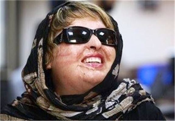 آمنه بهرامی